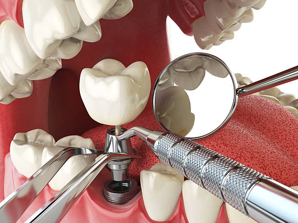 Best Urgent Tooth Repair  in North Sarasota, FL